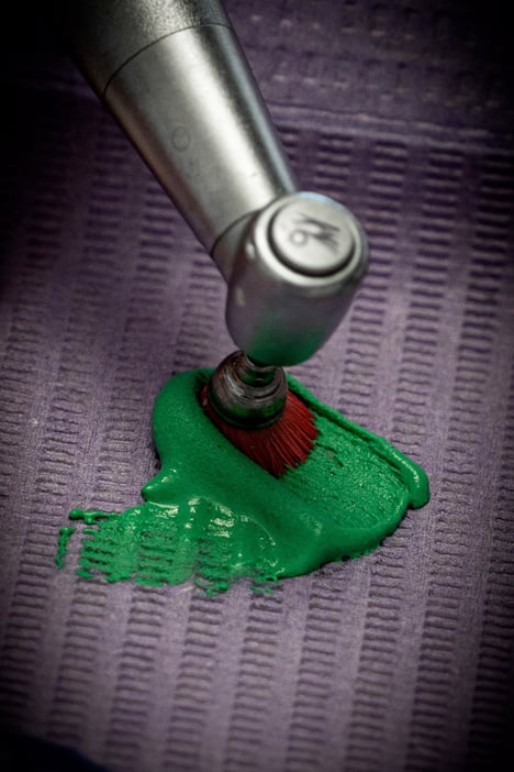 igiene-dentale-4